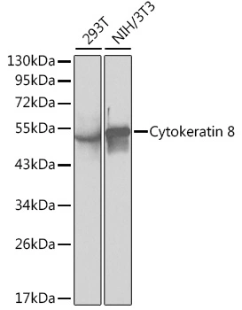 WB analysis of various sample lysates using GTX32549 Cytokeratin 8 antibody. Dilution : 1:1000 Loading : 25microg per lane