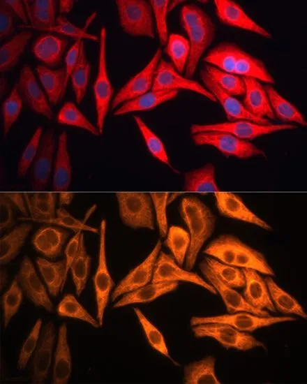 ICC/IF analysis of HeLa cells using GTX32549 Cytokeratin 8 antibody. Blue : DAPI Dilution : 1:100