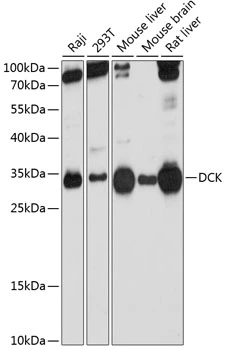 WB analysis of various sample lysates using GTX32553 DCK antibody. Dilution : 1:1000 Loading : 25microg per lane WB analysis of various sample lysates using GTX32553 DCK antibody. Dilution : 1:1000 Loading : 25microg per lane