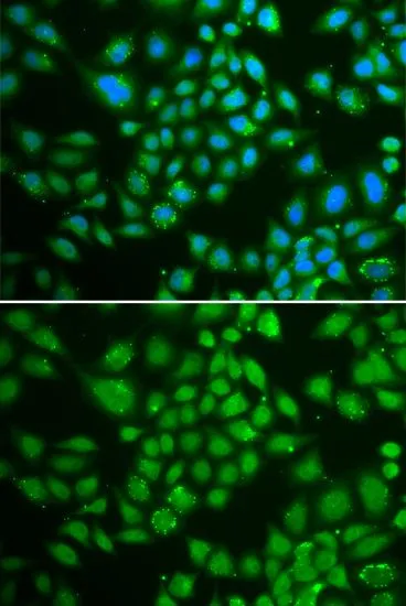 ICC/IF analysis of HeLa cells using GTX32553 DCK antibody. Blue : DAPI
