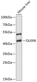 WB analysis of mouse liver tissue lysate using GTX32567 DUSP6 antibody. Dilution : 1:3000 Loading : 25microg per lane WB analysis of mouse liver tissue lysate using GTX32567 DUSP6 antibody. Dilution : 1:3000 Loading : 25microg per lane