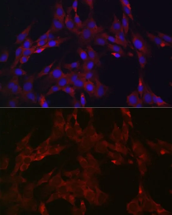 ICC/IF analysis of C6 cells using GTX32567 DUSP6 antibody. Blue : DAPI Dilution : 1:100