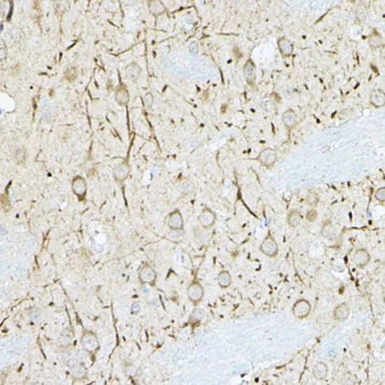 IHC-P analysis of rat brain tissue using GTX32567 DUSP6 antibody. Dilution : 1:100