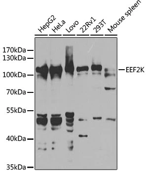 WB analysis of various sample lysates using GTX32573 eEF2K antibody. Dilution : 1:1000 Loading : 25microg per lane