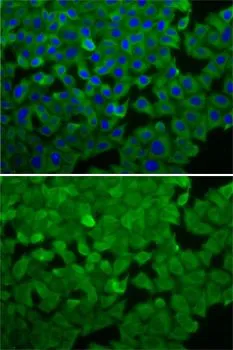 ICC/IF analysis of A549 cells using GTX32573 eEF2K antibody. Blue : DAPI