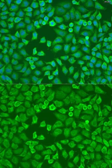 ICC/IF analysis of U2OS cells using GTX32578 EIF3A antibody. Blue : DAPI Dilution : 1:100