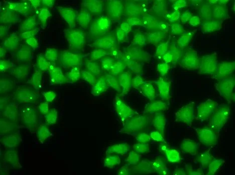 ICC/IF analysis of HeLa cells using GTX32579 eIF3e antibody.