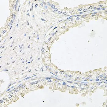 IHC-P analysis of human prostate tissue using GTX32590 EPO receptor antibody. Dilution : 1:100