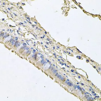 IHC-P analysis of human trachea tissue using GTX32590 EPO receptor antibody. Dilution : 1:100