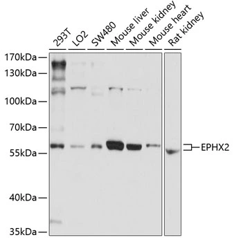 WB analysis of various sample lysates using GTX32591 EPXH2 antibody. The signal was developed with ECL plus-Enhanced. Dilution : 1:1000 Loading : 25microg per lane WB analysis of various sample lysates using GTX32591 EPXH2 antibody. The signal was developed with ECL plus-Enhanced. Dilution : 1:1000 Loading : 25microg per lane