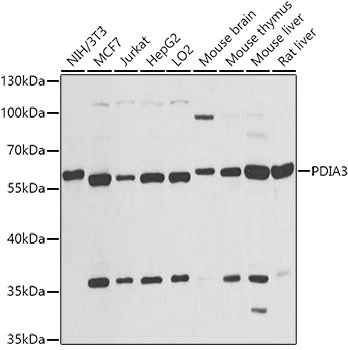 WB analysis of various sample lysates using GTX32592 ERp57 antibody. Dilution : 1:1000 Loading : 25microg per lane WB analysis of various sample lysates using GTX32592 ERp57 antibody. Dilution : 1:1000 Loading : 25microg per lane