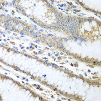 IHC-P analysis of human stomach tissue using GTX32592 ERp57 antibody. Dilution : 1:100