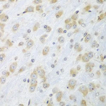IHC-P analysis of mouse brain tissue using GTX32592 ERp57 antibody. Dilution : 1:100