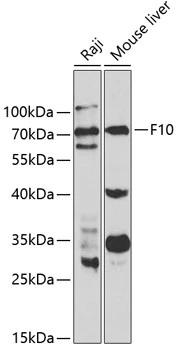 WB analysis of various sample lysates using GTX32595 Factor X antibody. Dilution : 1:1000 Loading : 25microg per lane WB analysis of various sample lysates using GTX32595 Factor X antibody. Dilution : 1:1000 Loading : 25microg per lane