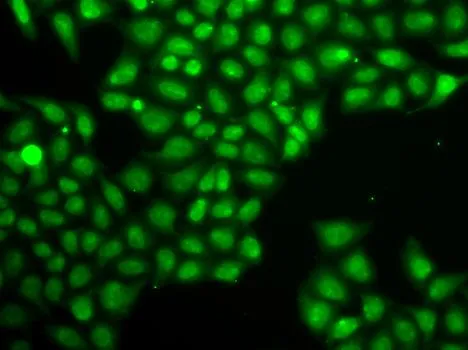 ICC/IF analysis of A549 cells using GTX32600 FEN1 antibody.