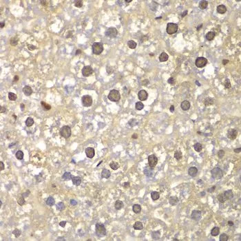 IHC-P analysis of mouse liver tissue using GTX32600 FEN1 antibody. Dilution : 1:100