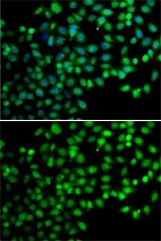 ICC/IF analysis of A549 cells using GTX32605 FKBP6 antibody. Blue : DAPI