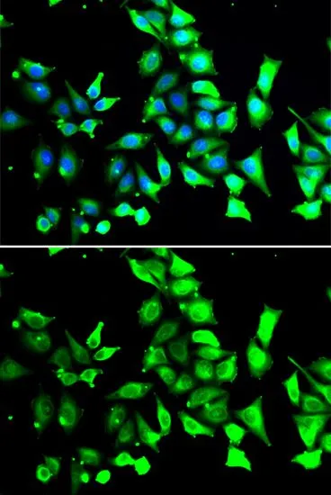 ICC/IF analysis of A549 cells using GTX32606 FKBP8 antibody. Blue : DAPI