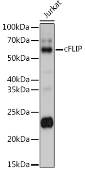 WB analysis of Jurkat cell lysate using GTX32608 FLIP antibody. Dilution : 1:1000 Loading : 25microg per lane WB analysis of Jurkat cell lysate using GTX32608 FLIP antibody. Dilution : 1:1000 Loading : 25microg per lane