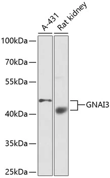 WB analysis of various sample lysates using GTX32614 GNAI3 antibody. The signal was developed with ECL plus-Enhanced. Dilution : 1:1000 Loading : 25microg per lane WB analysis of various sample lysates using GTX32614 GNAI3 antibody. The signal was developed with ECL plus-Enhanced. Dilution : 1:1000 Loading : 25microg per lane