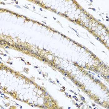 IHC-P analysis of human stomach tissue using GTX32614 GNAI3 antibody. Dilution : 1:100