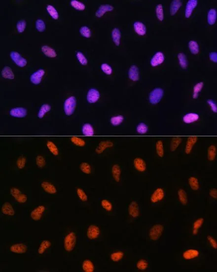 ICC/IF analysis of U2OS cells using GTX32616 GADD153 antibody. Blue : DAPI Dilution : 1:100