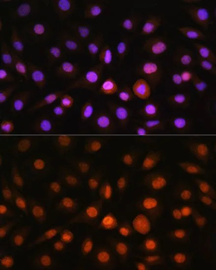 ICC/IF analysis of L929 cells using GTX32616 GADD153 antibody. Blue : DAPI Dilution : 1:100