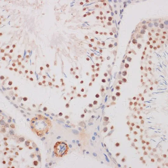 IHC-P analysis of rat testis tissue using GTX32616 GADD153 antibody. Dilution : 1:100