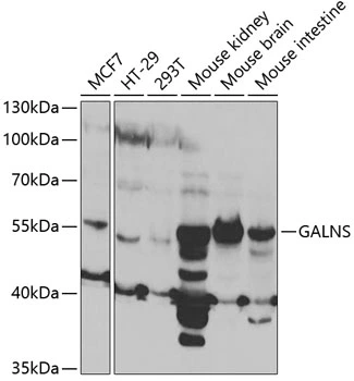 WB analysis of various sample lysates using GTX32618 GALNS antibody. Dilution : 1:1000 Loading : 25microg per lane WB analysis of various sample lysates using GTX32618 GALNS antibody. Dilution : 1:1000 Loading : 25microg per lane