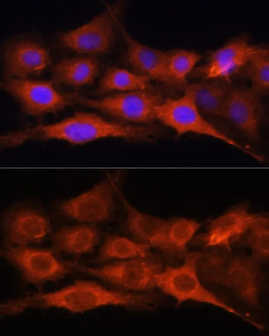 ICC/IF analysis of C6 cells using GTX32618 GALNS antibody. Blue : DAPI Dilution : 1:100