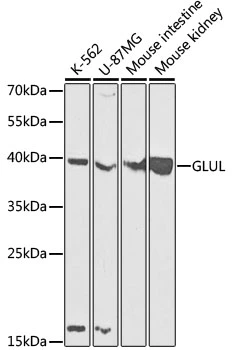 WB analysis of various sample lysates using GTX32627 Glutamine synthetase antibody. Dilution : 1:1000 Loading : 25microg per lane