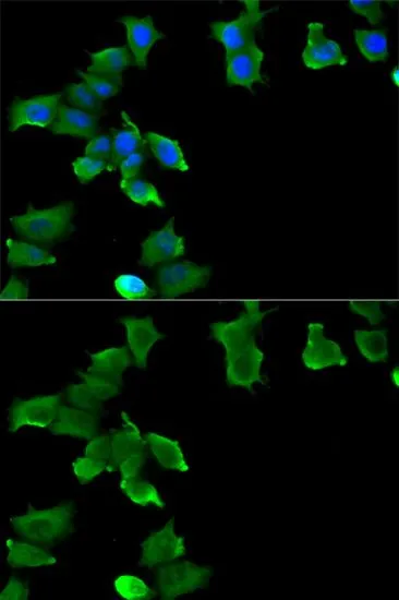 ICC/IF analysis of MCF7 cells using GTX32627 Glutamine synthetase antibody. Blue : DAPI