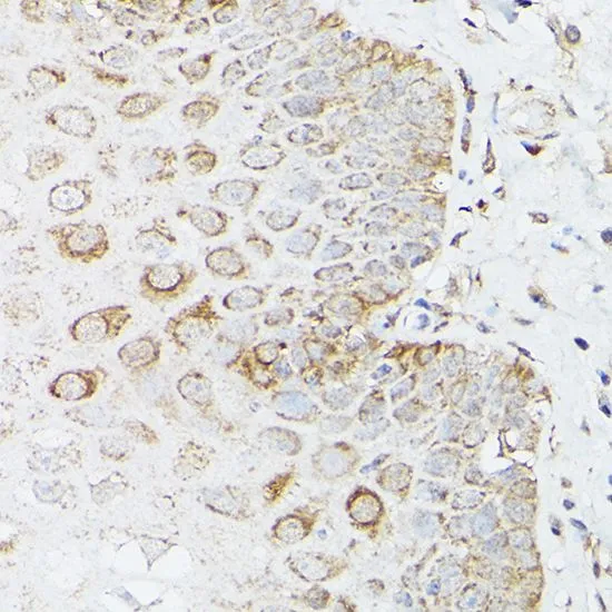 IHC-P analysis of human stomach tissue using GTX32627 Glutamine synthetase antibody. Dilution : 1:100