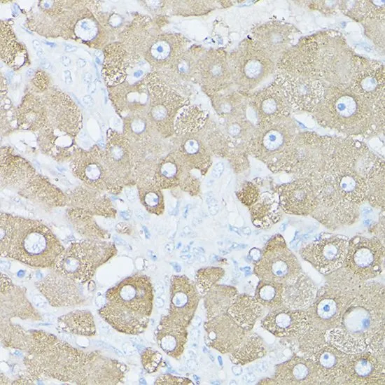 IHC-P analysis of mouse lung tissue using GTX32627 Glutamine synthetase antibody. Dilution : 1:100