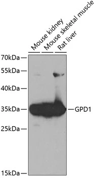 WB analysis of various sample lysates using GTX32630 GPD1 antibody. Dilution : 1:1000 Loading : 25microg per lane WB analysis of various sample lysates using GTX32630 GPD1 antibody. Dilution : 1:1000 Loading : 25microg per lane