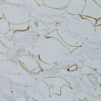 IHC-P analysis of human breast adipocytes tissue using GTX32630 GPD1 antibody. Dilution : 1:100