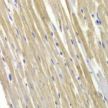 IHC-P analysis of rat heart tissue using GTX32630 GPD1 antibody. Dilution : 1:100
