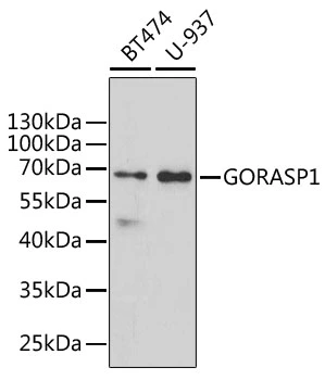 WB analysis of various sample lysates using GTX32631 GRASP65 antibody. Dilution : 1:1000 Loading : 25microg per lane WB analysis of various sample lysates using GTX32631 GRASP65 antibody. Dilution : 1:1000 Loading : 25microg per lane