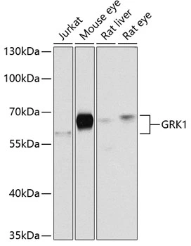 WB analysis of various sample lysates using GTX32635 GRK1 antibody. Dilution : 1:1000 Loading : 25microg per lane WB analysis of various sample lysates using GTX32635 GRK1 antibody. Dilution : 1:1000 Loading : 25microg per lane