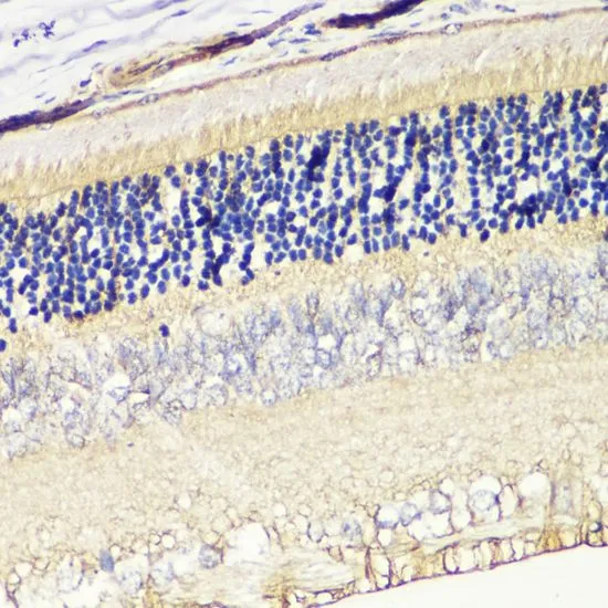 IHC-P analysis of rat retina tissue using GTX32635 GRK1 antibody. Dilution : 1:200