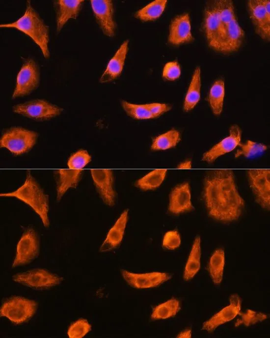 ICC/IF analysis of L929 cells using GTX32639 GSTP1 antibody. Blue : DAPI Dilution : 1:100