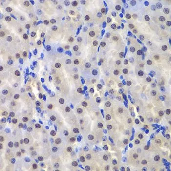 IHC-P analysis of mouse kidney tissue using GTX32639 GSTP1 antibody. Dilution : 1:200