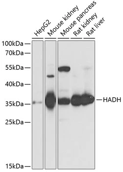 WB analysis of various sample lysates using GTX32641 HADH antibody. Dilution : 1:1000 Loading : 25microg per lane WB analysis of various sample lysates using GTX32641 HADH antibody. Dilution : 1:1000 Loading : 25microg per lane