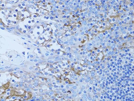IHC-P analysis of human tonsil tissue using GTX32641 HADH antibody. Dilution : 1:100
