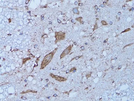 IHC-P analysis of rat spinal cord tissue using GTX32641 HADH antibody. Dilution : 1:100