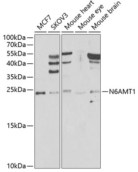 WB analysis of various sample lysates using GTX32649 HEMK2 antibody. The signal was developed with ECL plus-Enhanced. Dilution : 1:1000 Loading : 25microg per lane WB analysis of various sample lysates using GTX32649 HEMK2 antibody. The signal was developed with ECL plus-Enhanced. Dilution : 1:1000 Loading : 25microg per lane