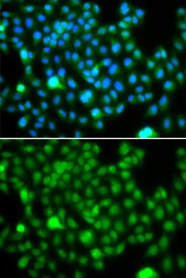ICC/IF analysis of A549 cells using GTX32649 HEMK2 antibody. Blue : DAPI