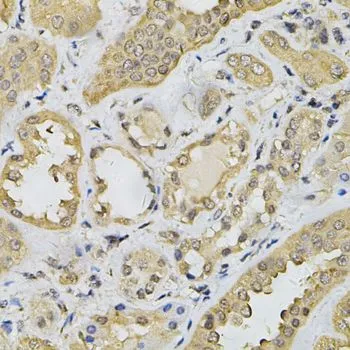 IHC-P analysis of human kidney tissue using GTX32649 HEMK2 antibody. Dilution : 1:100