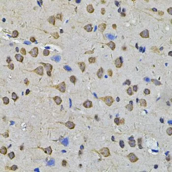 IHC-P analysis of rat brain tissue using GTX32649 HEMK2 antibody. Dilution : 1:100