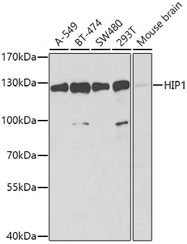 WB analysis of various sample lysates using GTX32653 HIP1 antibody. Dilution : 1:1000 Loading : 25microg per lane WB analysis of various sample lysates using GTX32653 HIP1 antibody. Dilution : 1:1000 Loading : 25microg per lane